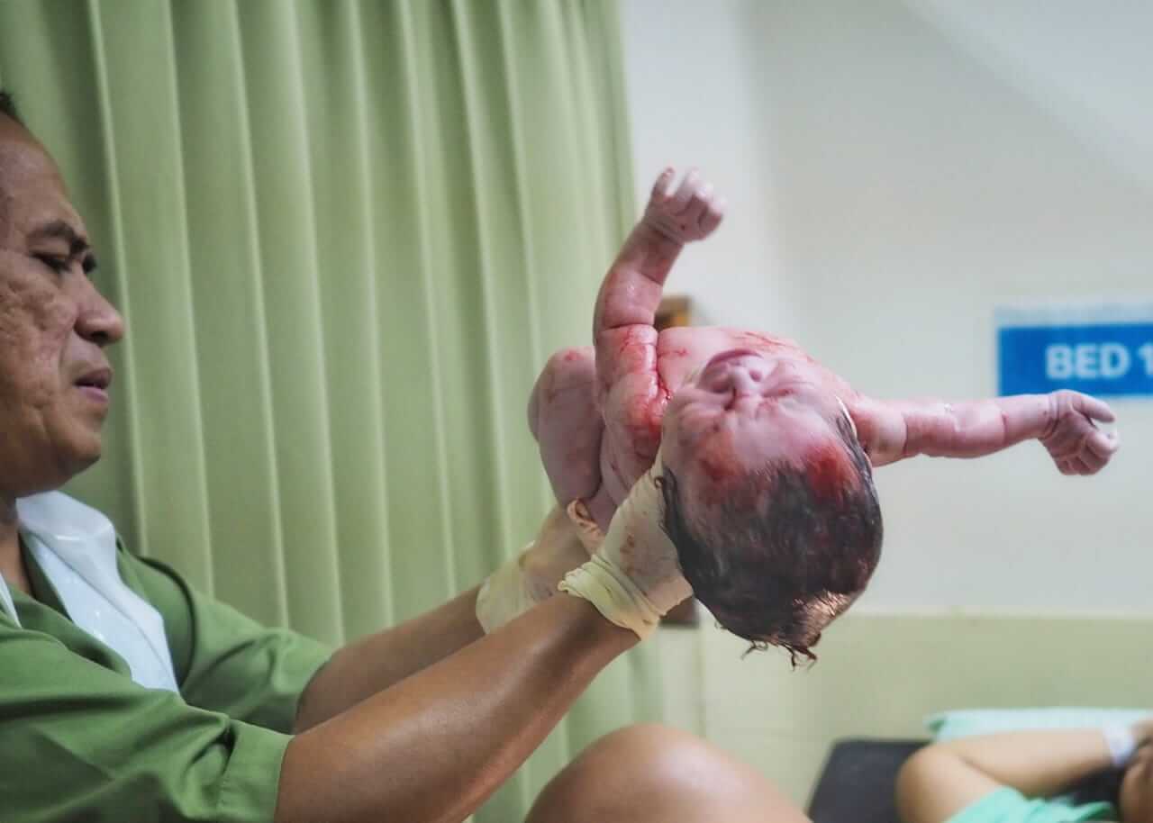 Dr. I Ketut Sudhaberata Purna mengangkat bayi baru lahir dengan penuh kehati-hatian setelah proses persalinan.