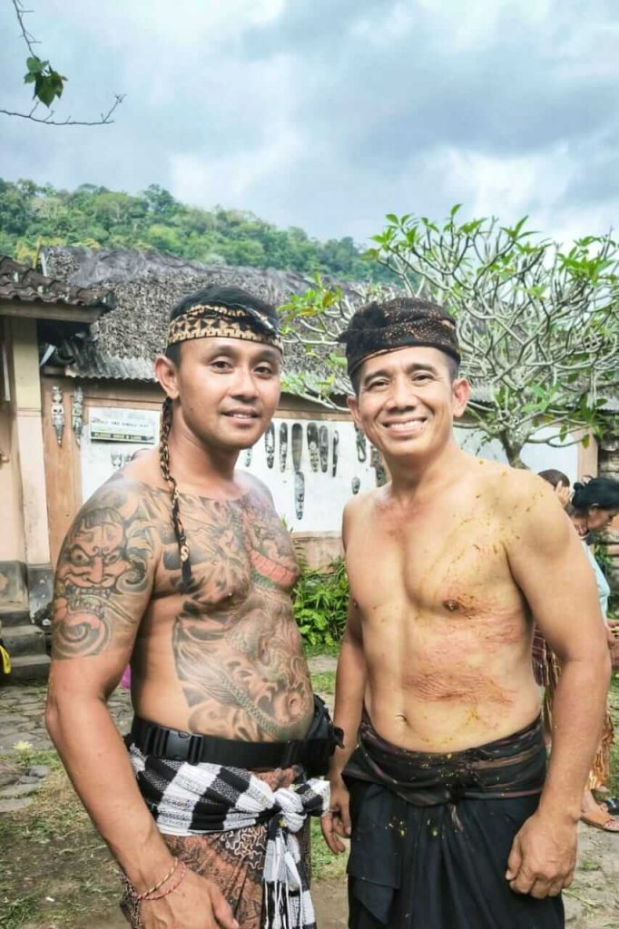 Bekas luka di tubuh Puja Astawa sebagai bukti partisipasinya dalam tradisi Perang Pandan di Bali.