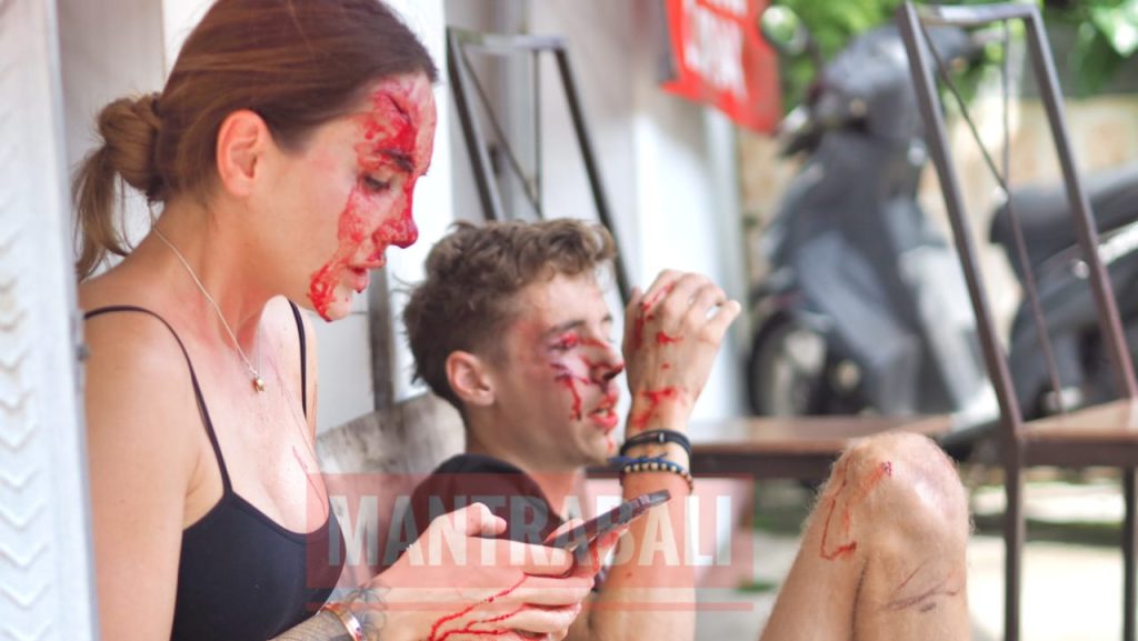 Dua warga negara asing mengalami luka serius setelah sepeda motor yang mereka kendarai terlibat kecelakaan di Jalan Pura Batu Pageh, Ungasan, Bali.