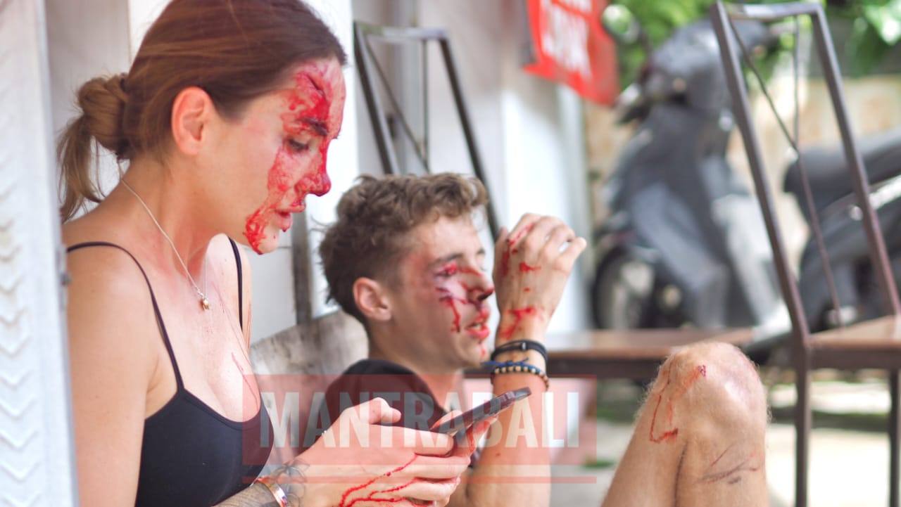 Dua warga negara asing mengalami luka serius setelah sepeda motor yang mereka kendarai terlibat kecelakaan di Jalan Pura Batu Pageh, Ungasan, Bali.